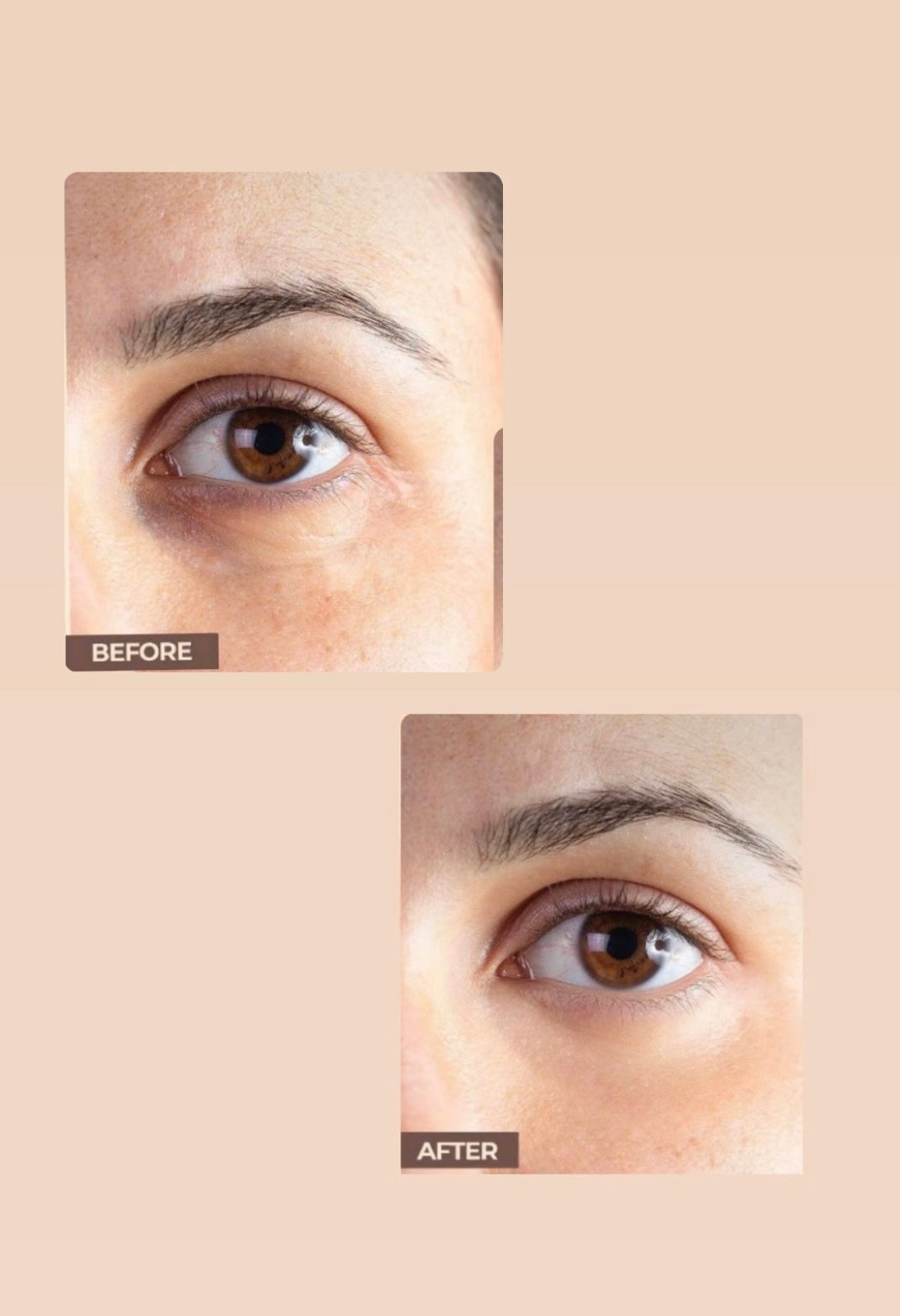 Eye Gel